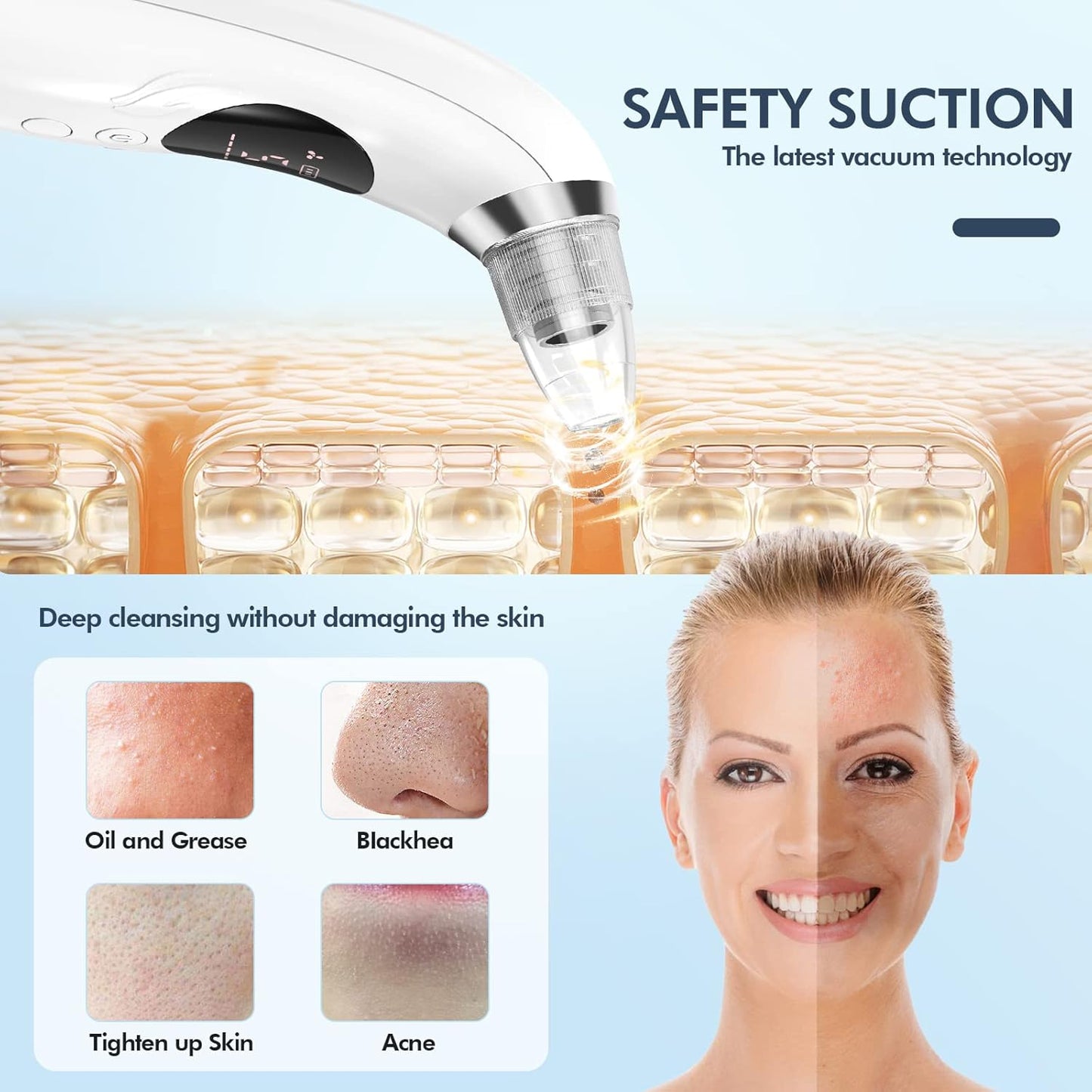 Vacuum Blackhead Remover Electric Facial Cleanser